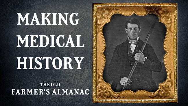 making medical history, phineas gage, the first lobotomy