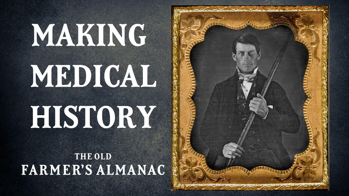 making medical history, phineas gage, the first lobotomy